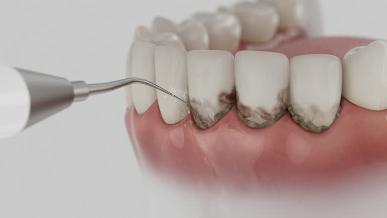 Trusted Root Canal Treatment service in Edgerton, WI - Dentist Open Now